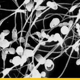 light-sensing-chip-captures-elusive-sperm-swimming-pattern 1 1
